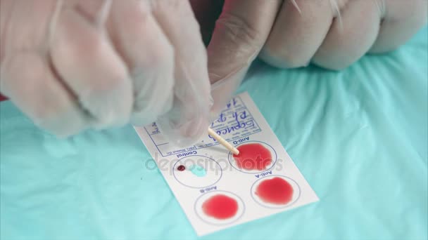 Arzt beendet Prozess der Blutmischung und Auflösung von Antikörpern — Stockvideo