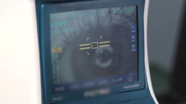 Close-up shot van de autorefractor, waarin de oogbol — Stockvideo