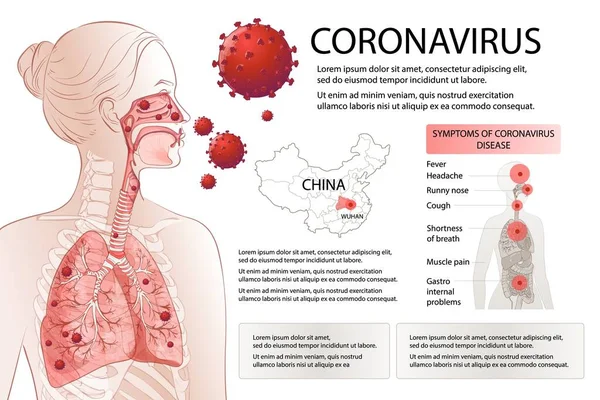 Ανθρώπινα MERS-Cov παράγοντες κινδύνου συμπτώματα. Η επιδημία του ιού εξαπλώθηκε πανδημία. — Διανυσματικό Αρχείο