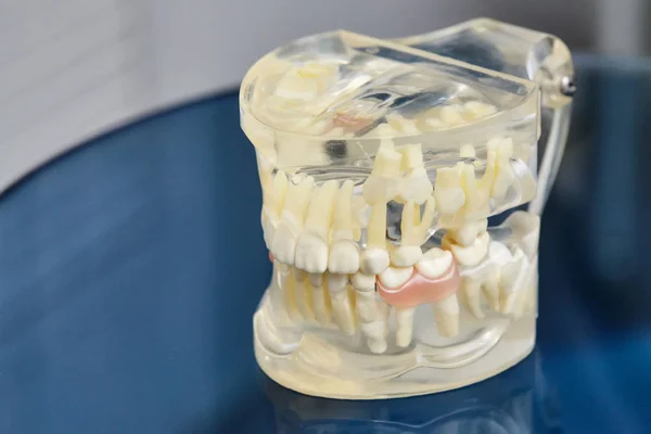 Mandíbula humana ou dentes modelo odontológico ortodôntico — Fotografia de Stock