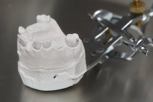 グレー歯科用歯の金型、粘土人間の歯茎モデル — ストック写真
