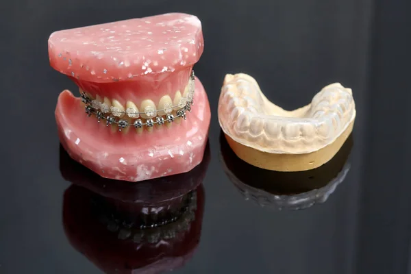 Modelo de mandíbula ou dentes humanos com aparelho dentário com fios metálicos — Fotografia de Stock