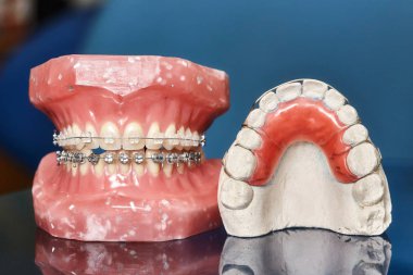 İnsan çene veya diş modeli ile metal diş diş telleri kablolu