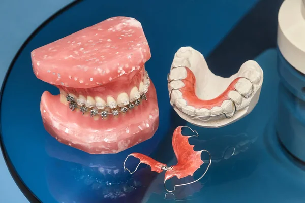 Modelo de mandíbula ou dentes humanos com aparelho dentário com fios metálicos — Fotografia de Stock