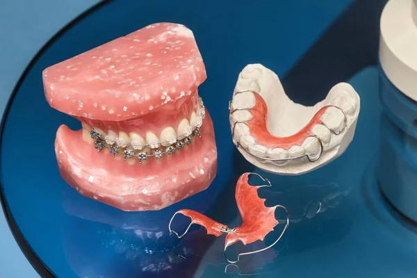 Modelo de mandíbula o dientes humanos con abrazaderas dentales con cable metálico — Foto de Stock