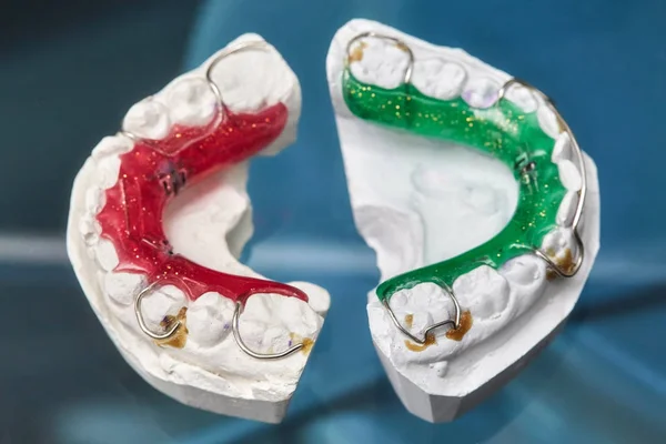 Frenos dentales coloridos o retenedores para dientes sobre fondo de vidrio — Foto de Stock