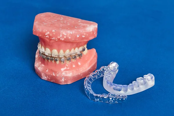 Modelo de mandíbula o dientes humanos con abrazaderas dentales con cable metálico — Foto de Stock