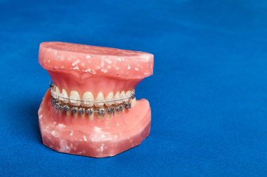 İnsan çene veya diş modeli ile metal diş diş telleri kablolu