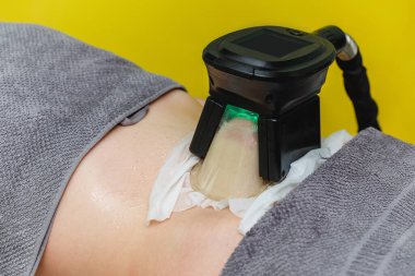Kadın Cryolipolysis şişman tedavi prosedürü profesyonel kozmetik kabine veya spa Center'da alıyorum.