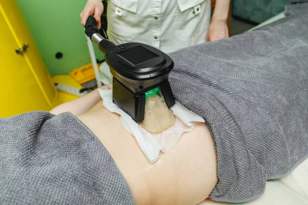 Mujer Recibiendo Criolipólisis Procedimiento Tratamiento Grasa Salón Belleza — Foto de Stock