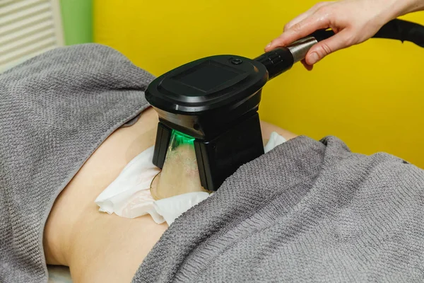 Mulher Recebendo Cryolipolysis Procedimento Tratamento Gordura Salão Beleza — Fotografia de Stock