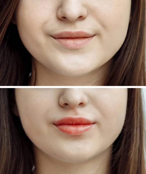 Porównanie Zdjęć Przed Trwałym Makijażu Tatuaż Ust Dla Kobiety Salonie — Zdjęcie stockowe
