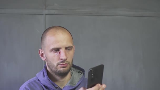 Employé masculin blessé à la tête utilisant un smartphone — Video