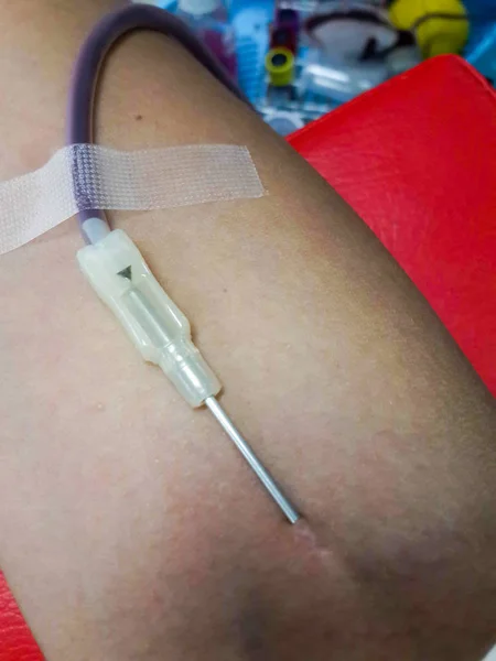 献血、輸血のクローズ アップ, — ストック写真