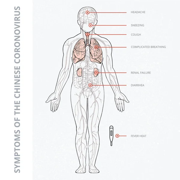 Uma ilustração esquemática do corpo humano com um infográfico dos sintomas do coronavírus covid 19 . — Vetor de Stock