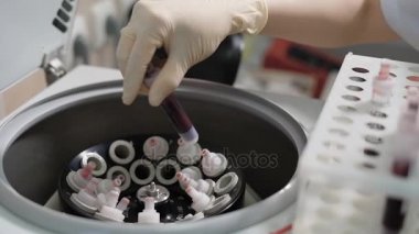 Bir santrifüj tüpleri sıvı bir laboratuvar test döner. Bir sağlık görevlisi ya da doktor, kan örneklerini yükleme bir santrifüj içine katılan. Cihazın kan fraksiyonları böler.