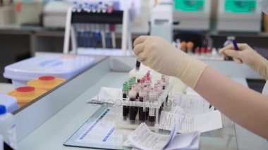 Kırpma elleri numune kontrol uzmanı. Kırpma eller kanlı arka plan bulanık numune kontrol laboratuar işçisi.
