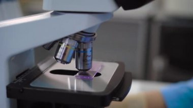 A yakın bir hastanede tedavi edilir nerede hastaların kan testleri incelendiği, bir özel klinik, laboratuvar mikroskop bir metal parçası ateş