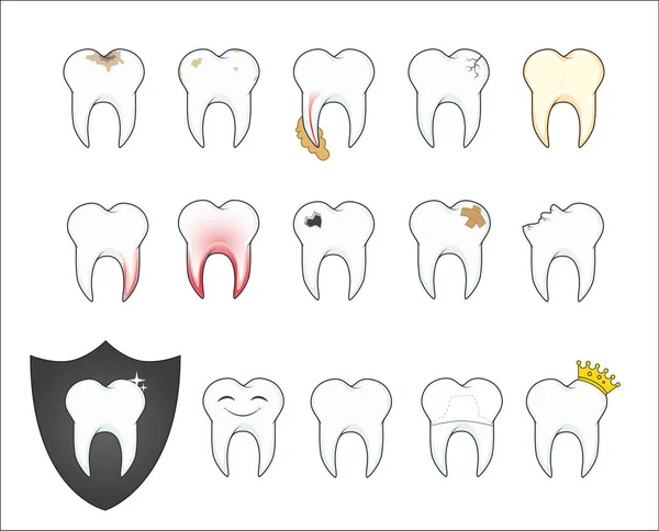 Поганий зуб з нальотом і порожниною. Векторні ілюстрації . — стоковий вектор