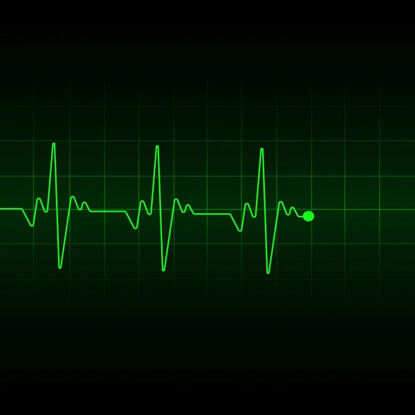 Luce di impulso del cuore verde effetto trasparente, elettrocardiogramma. Illustrazione vettoriale . — Vettoriale Stock