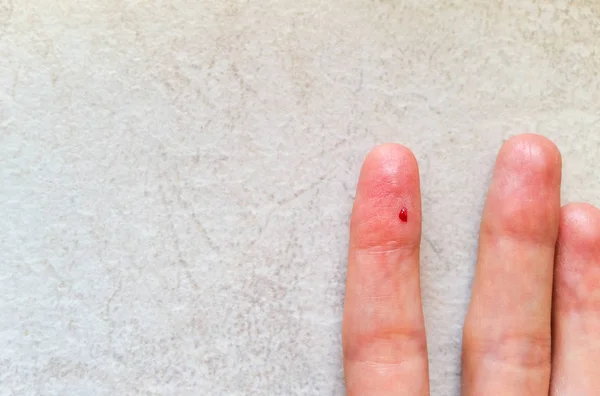 Крупный план женского пальца с каплей крови для анализа крови — стоковое фото