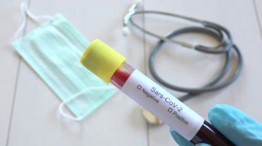 Covid-19 hastalığının pozitif kan testi sonuçlarını gösteren doktor, 2019-ncov, mavi eldivenli analist Sars-Cov-2 enfeksiyon kontrolü, doktor elleri test tüpüne Coronavirus teşhisi yazıyor
