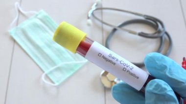 Covid-19 hastalığını işaretleyen doktor negatif kan testi sonuçları, 2019-Ncov, mavi eldivenli analist Sars-Cov-2 enfeksiyon kontrolü, doktor elleri test tüpüne Coronavirus teşhisi yazıyor.
