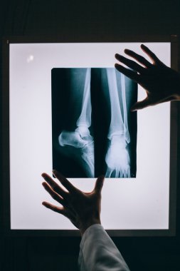 İnsan vücudunun X-Ray tarama