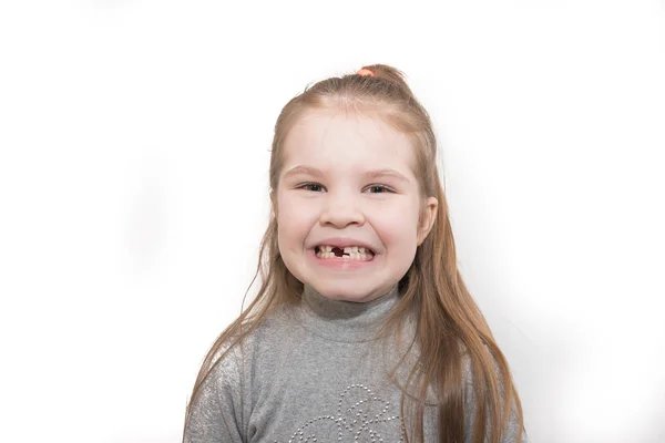 Μικρό κορίτσι δείχνει δόντια που λείπουν, απομονώνονται σε λευκό φόντο — Φωτογραφία Αρχείου