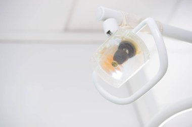 Dişçi aleti diş Kliniği. İşlem, diş değiştirme.