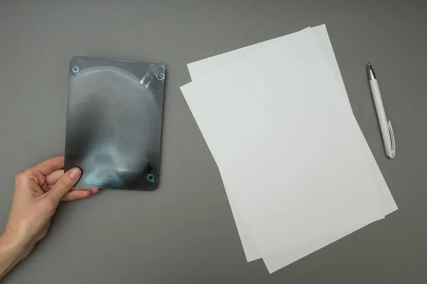 X-ray image near a blank sheet of paper — Stock Photo, Image