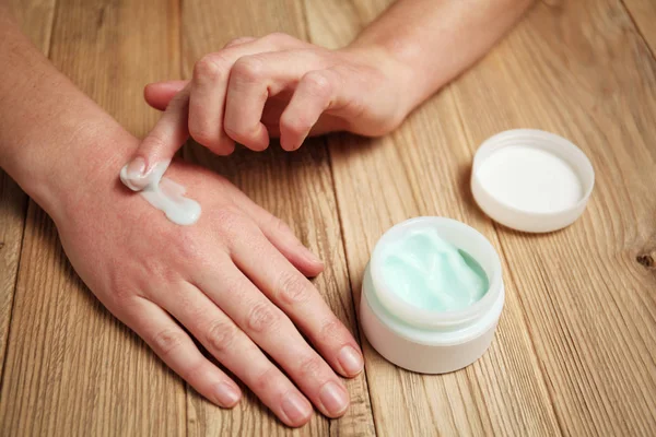 Les mains féminines appliquent un hydratant sur la peau. Irritation et aller — Photo