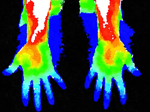 DW Palm termografi eller