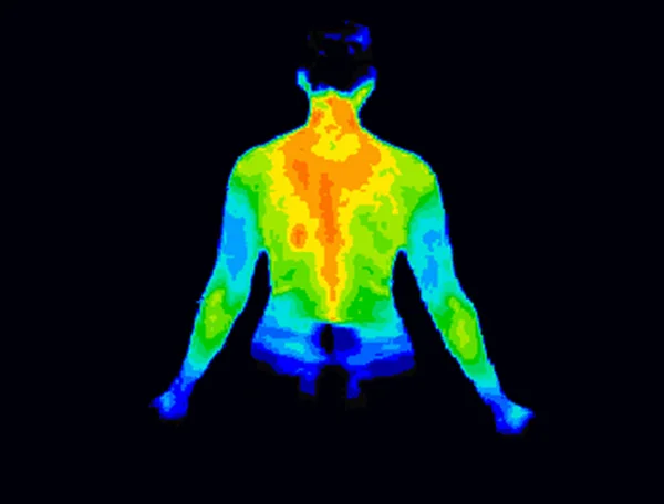 Upper body thermography — Stock Photo, Image