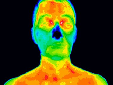 Yüz ve boyun termografi