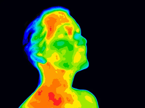 Face Thermograpy Carotid — Stock Photo, Image