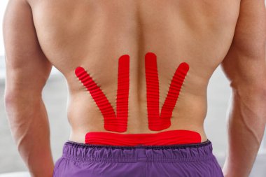 Kineziyoloji bandı. Fizyoterapist kineziyoloji bandı uyguluyor.