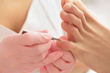 Özel çivi kullanan profesyonel pedikür. Hasta podiyatrisi. Cımbız kullanılarak tıbbi pedikür. SPA Salonu 'nda ayak tedavisi.