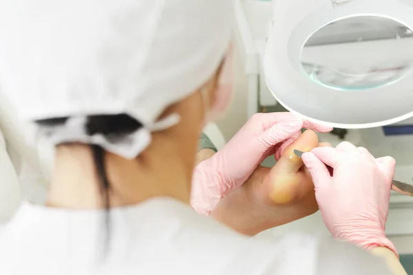 Trattamento piedi nel salone SPA. Clinica di podologia. Pedicure professionale con cuoio capelluto dieffenbach. Paziente in visita podologo. Procedura di pedicure medica utilizzando uno strumento speciale con supporto coltello lama — Foto Stock