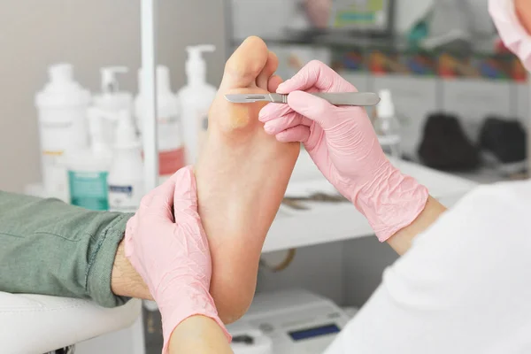 Pédicure professionnelle en utilisant le scalpel de dieffenbach. Patient visitant podiatre. Procédure de pédicure médicale en utilisant un instrument spécial avec porte-couteau à lame. Traitement des pieds dans le salon SPA. Clinique de podiatrie — Photo