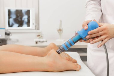 Extracorporeal Shockwave Therapy ESWT cerrahi olmayan tedaviler. Şok dalgalarıyla plantarfascitis için fizyoterapi. Ağrı kesici, normalleştirme ve yenilenme, iyileşme sürecinin canlandırılması.