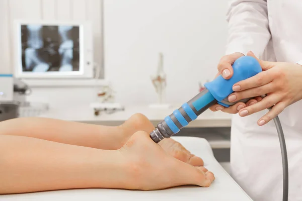 Extracorporeal Shockwave Therapy ESWT cerrahi olmayan tedaviler. Şok dalgalarıyla plantarfascitis için fizyoterapi. Ağrı kesici, normalleştirme ve yenilenme, iyileşme sürecinin canlandırılması.