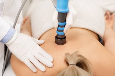 Extracorporeal Shockwave Therapy ESWT cerrahi olmayan tedavi. Boyun ve sırt kasları için fizik tedavi, şok dalgalarıyla omurga. Ağrı kesici, normalleşme ve yenilenme, canlandırma işlemleri, canlandırma süreci.