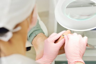 SPA Salonu 'nda ayak tedavisi. Ayak hastalıkları kliniği. Dieffenbach skaler kullanan profesyonel pedikür. Hasta podiyatristi ziyaret ediyor. Bıçak tutacağı olan özel bir aletle tıbbi pedikür uygulanıyor.