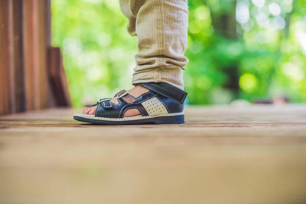 Orthopedic shoes on the boy's feet — Stock Photo, Image