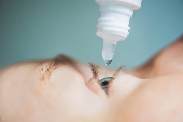 Closeup Eyedropper Putting Liquid Open Eye — Stock Photo, Image