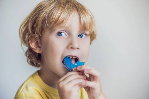 Niño de tres años muestra entrenador miofuncional para iluminar la boca — Foto de Stock