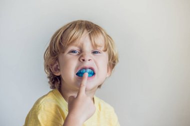 Ağız alışkanlığı nefes aydınlatmak için üç yaşında çocuk gösterileri myofunctional eğitmeni. Büyüyen dişler ve doğru şeyler dengelemek yardımcı olur. Dilin konumunu düzeltir.