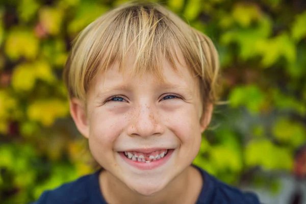 Pequeno menino sorridente mão apontando seu primeiro leite de bebê ou dente temporário cair — Fotografia de Stock