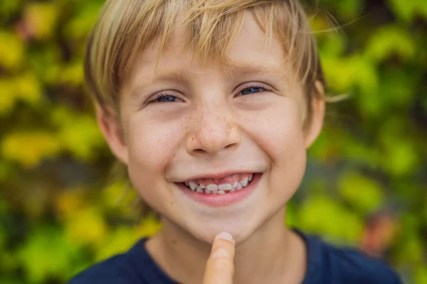 Little smiling child boy hand pointing his first baby milk or temporary tooth fall out — Stock Photo, Image